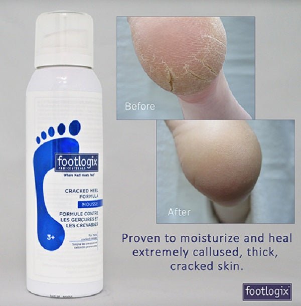 FOOTLOGIX #3E CRACKED HEEL FORMULA 4.2 OZ/125 ML - Purple Beauty Supplies